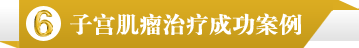 子宫肌瘤治疗成功案例